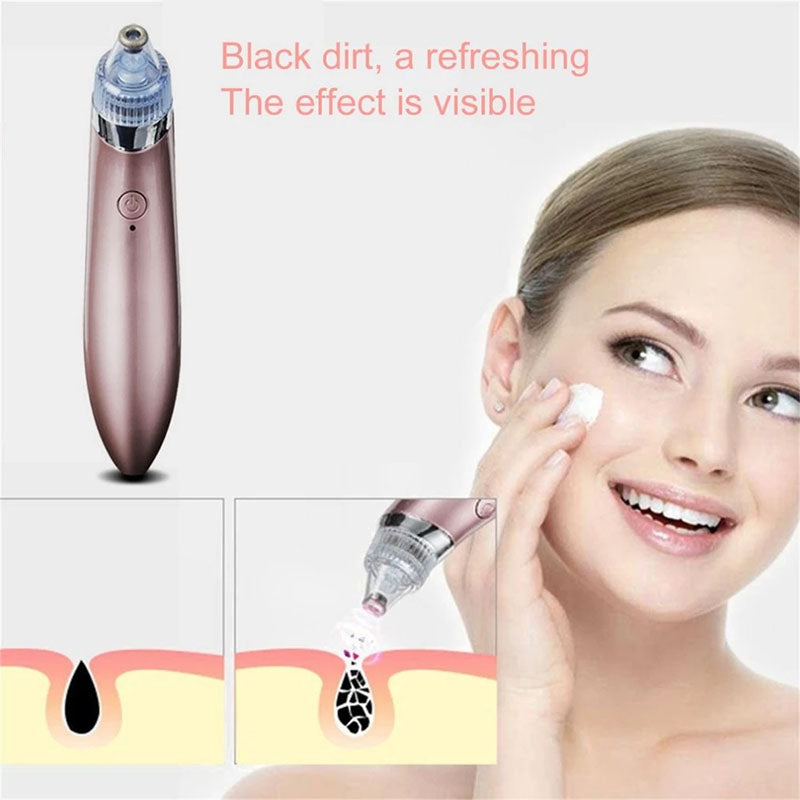 Portable Electric Blackhead Remover